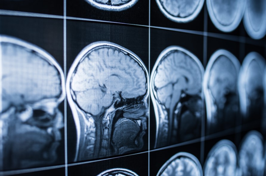 traumatic brain injury treatments